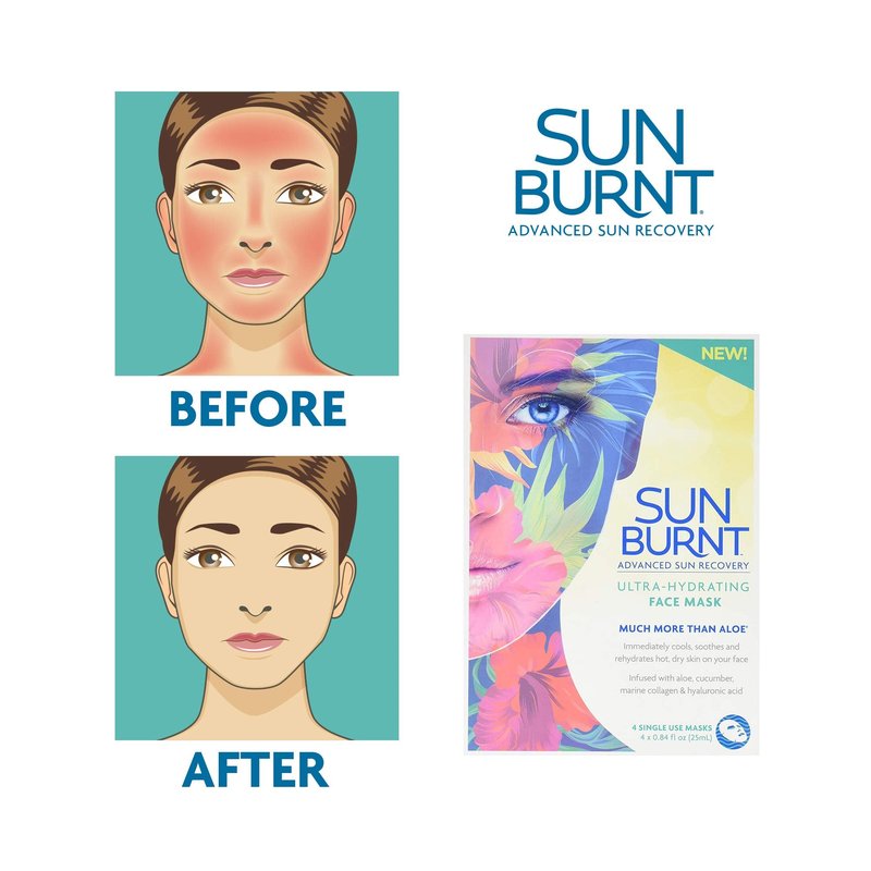 Sunburnt Ultra-Hydrating Face Sheet Mask, Advanced Sun Recovery, Treat Dry Sun Damaged Skin, For After Sun Exposure, Much More than Aloe, Soothes and Rehydrates Hot Dry Skin (4 single use masks)